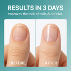 Keratin Nail Strengthener Oil | Fast-Dry Formula | Deep Moisture & Salon Shine (15ml)